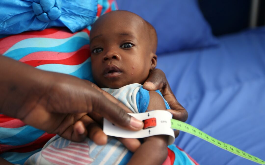Malnutrition woes overwhelm children in northeast Nigeria | Boko Haram | Al Jazeera